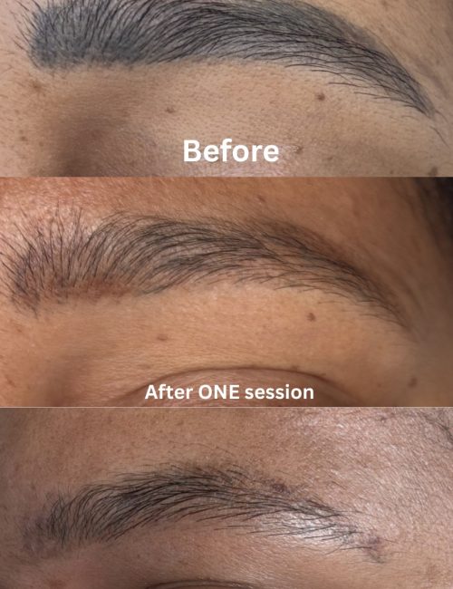 The secrets to keeping your skin moisturized - 1